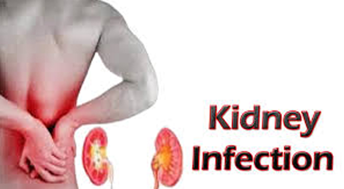 kidney_infection.jpg