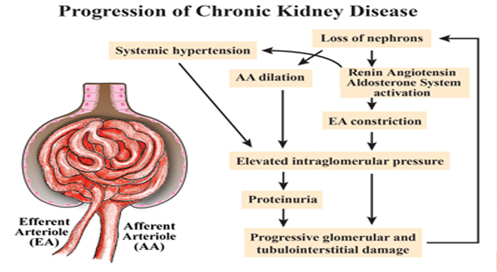 treatment_for_chronic_kidney_diseases.jpg